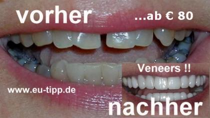 Zahnbehandlung in Tschechien - günstiger als Ungarn!!