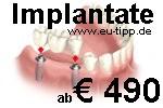 Zahnbehandlung + Urlaub - 1 Woche € 299 all inclusive