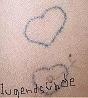 Tattoo-Entfernung ohne Lasern !!!