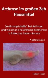 Arthrose im Großzeh - Schmerzen lindern