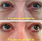 Faltenfrei in wenigen Minuten, Anti-Aging der neuen Ära, Sofort-Lifting pur!